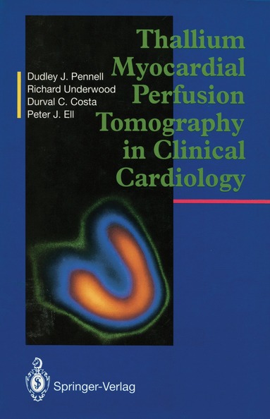 Dudley J. Pennell, S.Richard Underwood, Durval C. Costa, Peter J. Ell - Thallium Myocardial Perfusion Tomography in Clinical Cardiology, Häftad