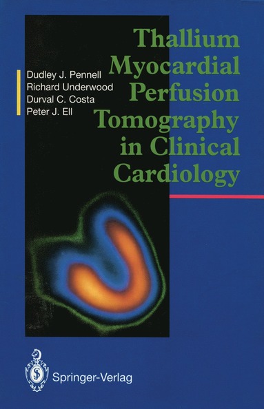 bokomslag Thallium Myocardial Perfusion Tomography in Clinical Cardiology