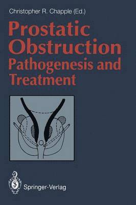 Prostatic Obstruction 1