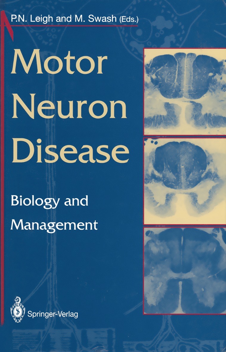 P.N. Leigh, Michael Swash, P. N. Leigh, Peter Nigel Leigh - Motor Neuron Disease, Häftad