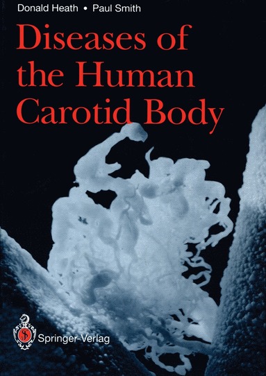 bokomslag Diseases of the Human Carotid Body