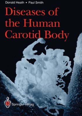 Diseases of the Human Carotid Body 1