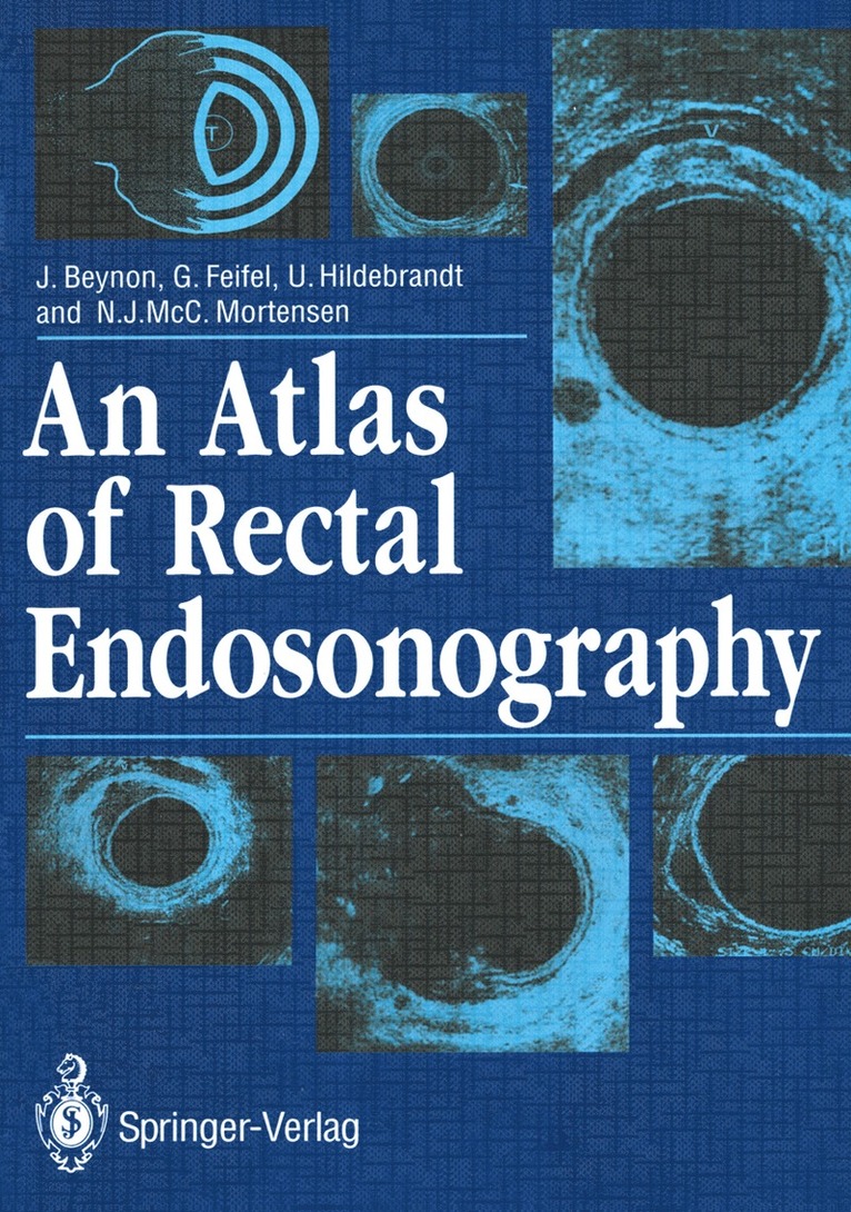 John Beynon, Gernot Feifel, Ulrich Hildebrandt, Neil Mortensen - Atlas of Rectal Endosonography, Häftad
