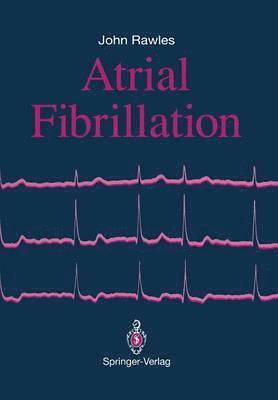 bokomslag Atrial Fibrillation