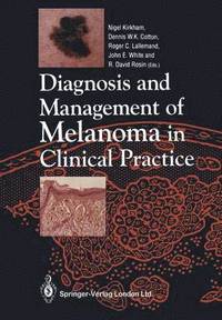 bokomslag Diagnosis and Management of Melanoma in Clinical Practice