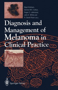 bokomslag Diagnosis and Management of Melanoma in Clinical Practice