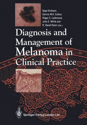 Diagnosis and Management of Melanoma in Clinical Practice 1