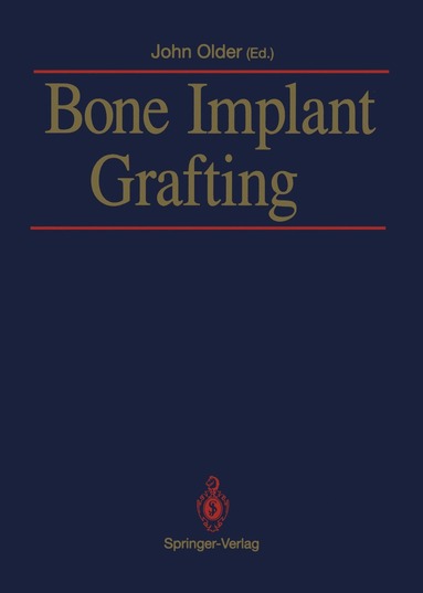 bokomslag Bone Implant Grafting