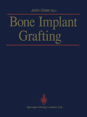 Bone Implant Grafting 1