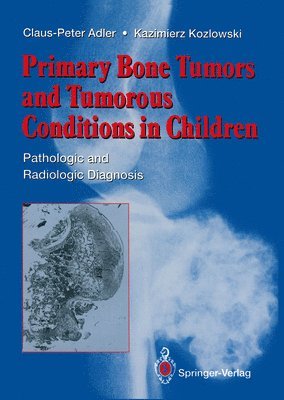 Primary Bone Tumors and Tumorous Conditions in Children 1