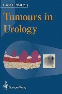 bokomslag Tumours in Urology