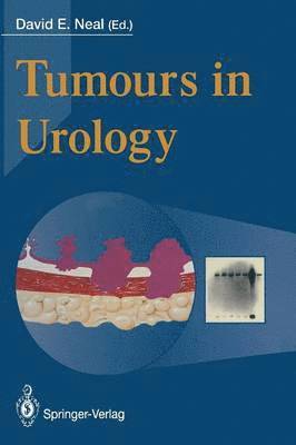 David E. Neal - Tumours in Urology, Häftad