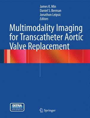 bokomslag Multimodality Imaging for Transcatheter Aortic Valve Replacement