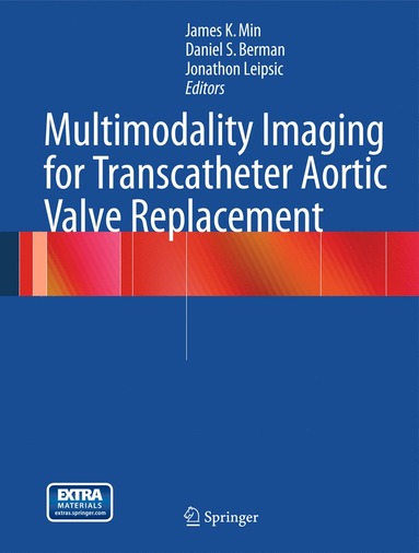 bokomslag Multimodality Imaging for Transcatheter Aortic Valve Replacement