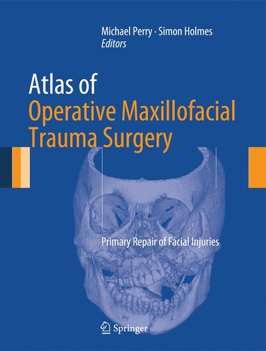 Michael Perry, Simon Holmes - Atlas of Operative Maxillofacial Trauma Surgery, Inbunden