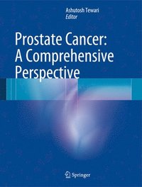 bokomslag Prostate Cancer: A Comprehensive Perspective