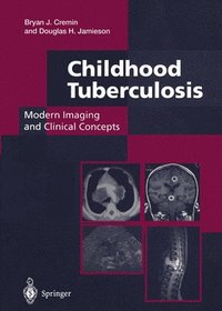 bokomslag Childhood Tuberculosis: Modern Imaging and Clinical Concepts