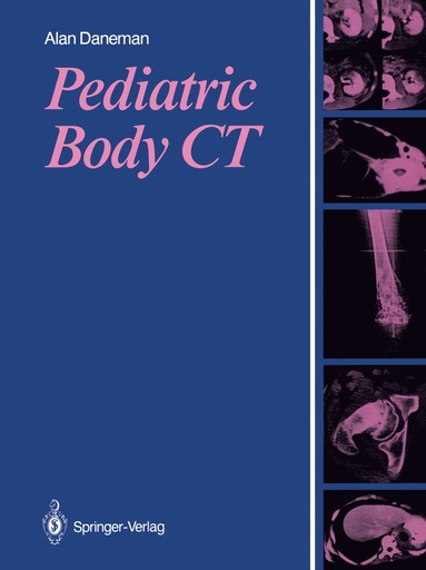 bokomslag Pediatric Body CT