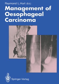 bokomslag Management of Oesophageal Carcinoma