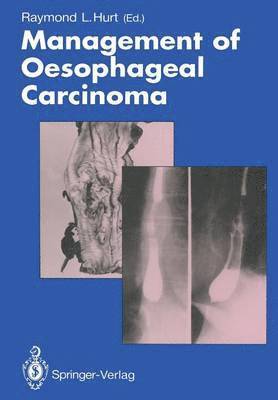 bokomslag Management of Oesophageal Carcinoma