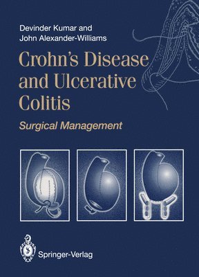 Devinder Kumar, John Alexander-Williams - Crohn’s Disease and Ulcerative Colitis, Häftad