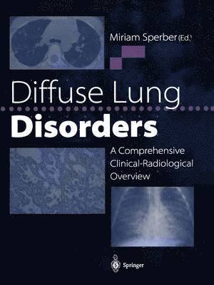 Diffuse Lung Disorders 1