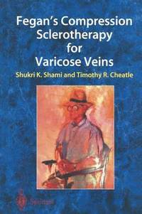 bokomslag Fegans Compression Sclerotherapy for Varicose Veins
