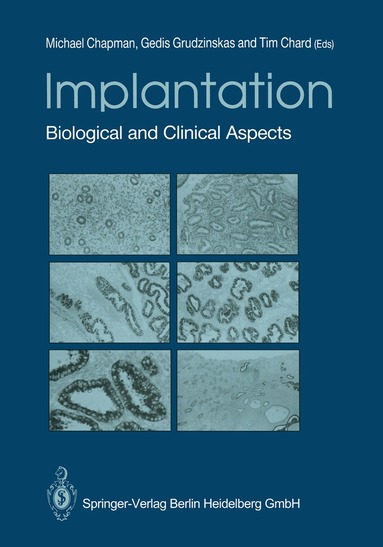Michael G. Chapman, J.Gedis Grudzinskas, Tim Chard - Implantation, Häftad