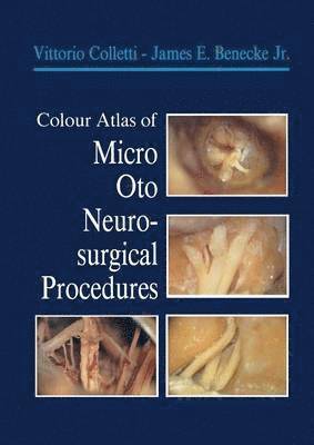 Colour Atlas of Micro-Oto-Neurosurgical Procedures 1