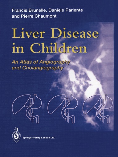 bokomslag Liver Disease in Children