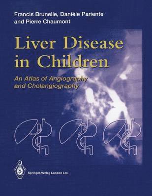 Liver Disease in Children 1