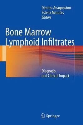 Bone Marrow Lymphoid Infiltrates 1