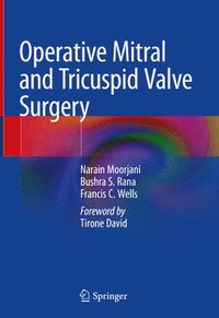 bokomslag Operative Mitral and Tricuspid Valve Surgery