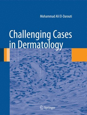 Challenging Cases in Dermatology 1