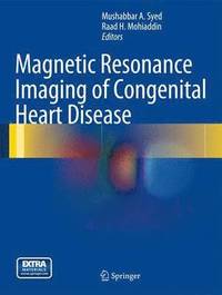 bokomslag Magnetic Resonance Imaging of Congenital Heart Disease