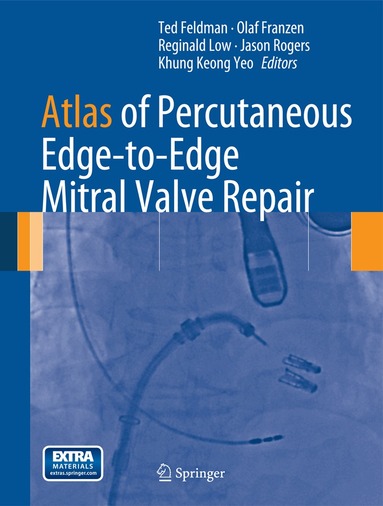 Ted Feldman, Olaf Franzen, Reginald Low, Jason Rogers, Khung Keong Yeo - Atlas of Percutaneous Edge-to-Edge Mitral Valve Repair, Inbunden