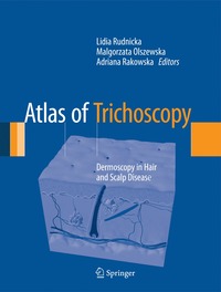 bokomslag Atlas of Trichoscopy