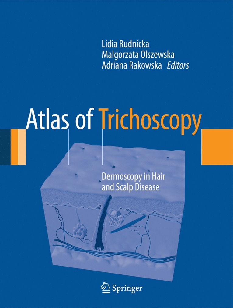Lidia Rudnicka, Malgorzata Olszewska, Adriana Rakowska - Atlas of Trichoscopy, Inbunden