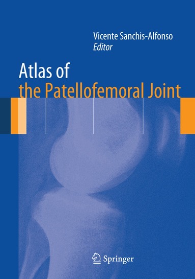 Vicente Sanchis-Alfonso - Atlas of the Patellofemoral Joint, Häftad