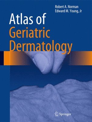 bokomslag Atlas of Geriatric Dermatology