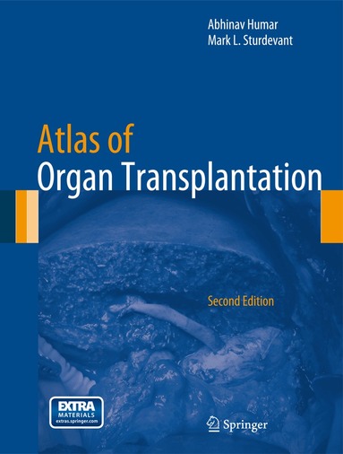Abhinav Humar, Mark L. Sturdevant - Atlas of Organ Transplantation, Inbunden