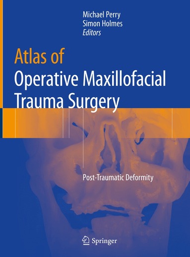 Michael Perry, Simon Holmes - Atlas of Operative Maxillofacial Trauma Surgery, Inbunden