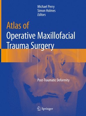 Atlas of Operative Maxillofacial Trauma Surgery 1