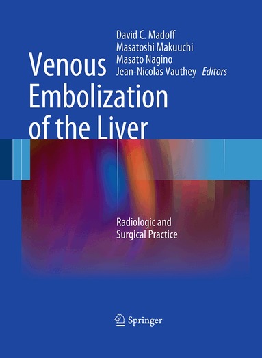 David C. Madoff, Masatoshi Makuuchi, Masato Nagino, Jean-Nicolas` Vauthey - Venous Embolization of the Liver, Häftad