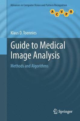 Guide to Medical Image Analysis 1