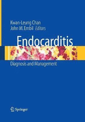 Endocarditis 1