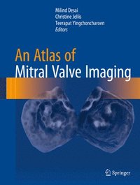 bokomslag An Atlas of Mitral Valve Imaging