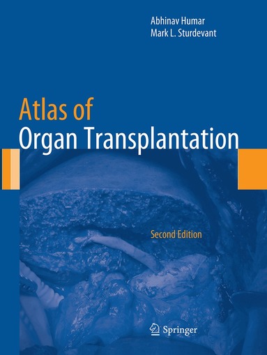 Abhinav Humar, Mark L. Sturdevant - Atlas of Organ Transplantation, Häftad
