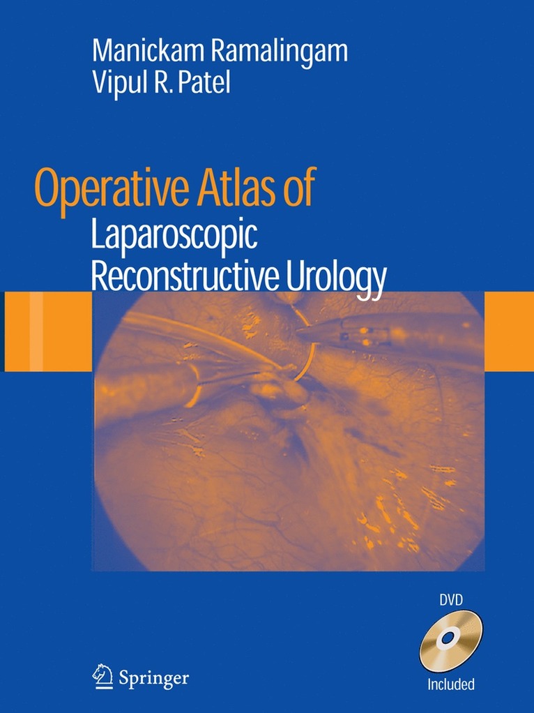 Manickam Ramalingam, Vipul R. Patel - Operative Atlas of Laparoscopic Reconstructive Urology, Häftad