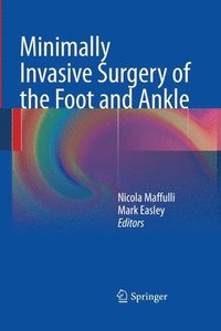 bokomslag Minimally Invasive Surgery of the Foot and Ankle